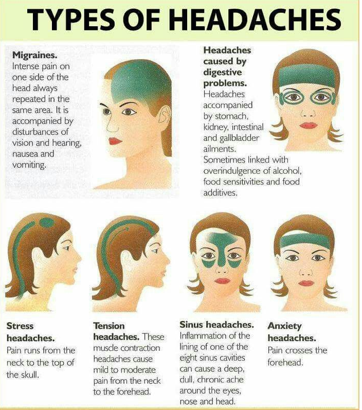 Causes Of All Kinds Of Headaches Order Fioricet   Typeofheadaches 